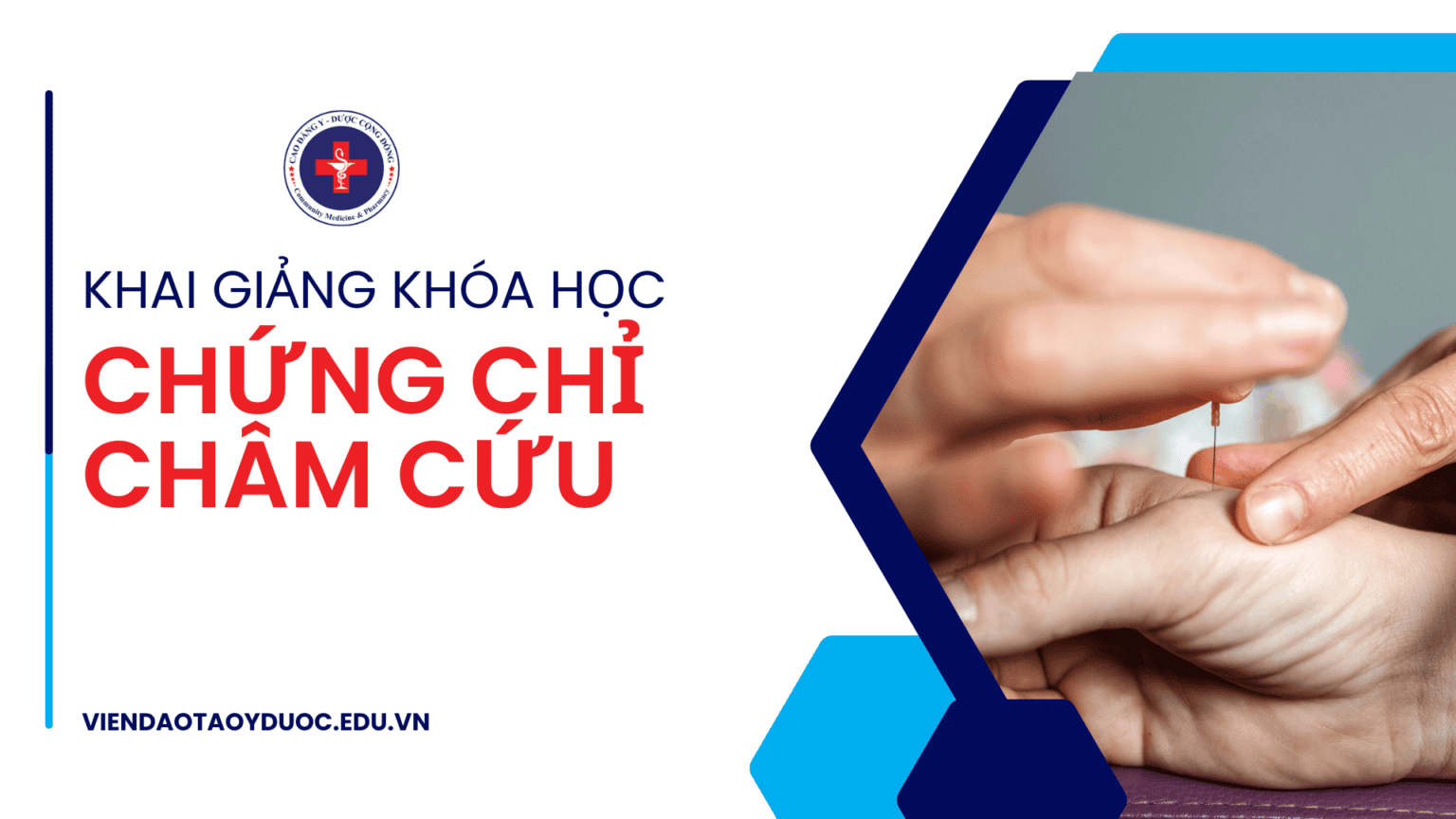 Khóa học chứng chỉ châm cứu 3 tháng - Cao Đẳng Y Dược Cộng Đồng